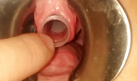 درمانگاه, پرستار, می خواستم سریع رابطه جنسی با یک sexخواهر بیمار